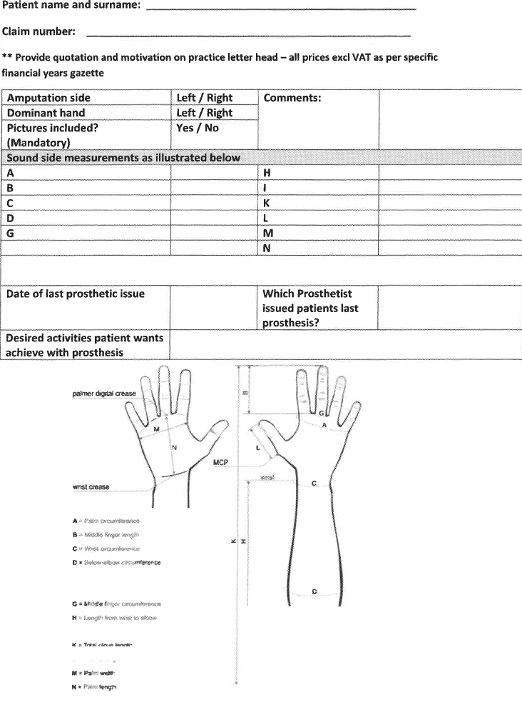 N149 Partial Hand Prothesis (1)